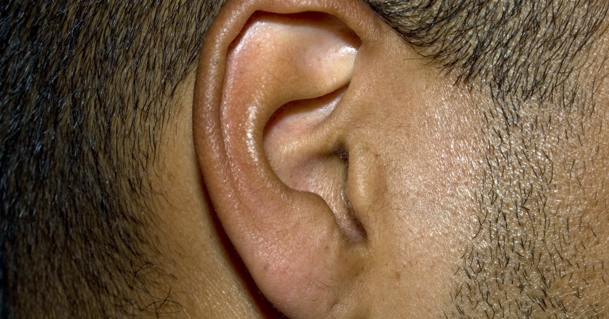 Борцовские уши фото